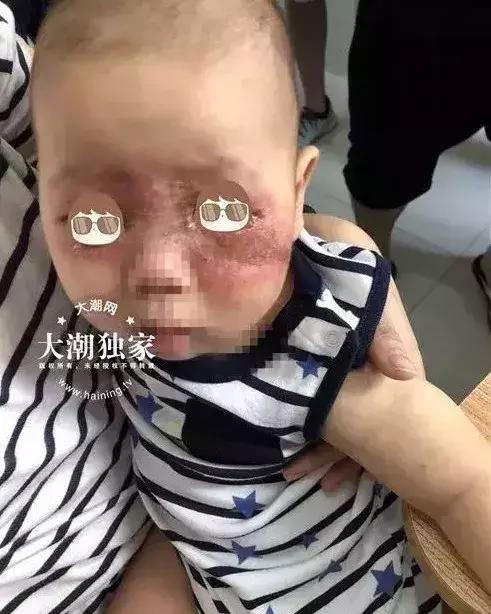 小心“新型艾滋病”，虫子就能传播！