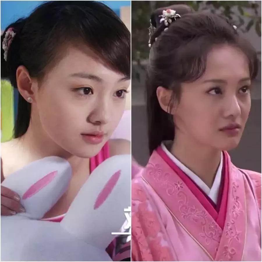 除了发量,最暴露年龄的可能是这两道纹