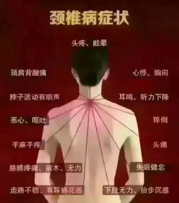 颈椎病的治疗方法和技巧,颈椎病的治疗最佳方法有哪些