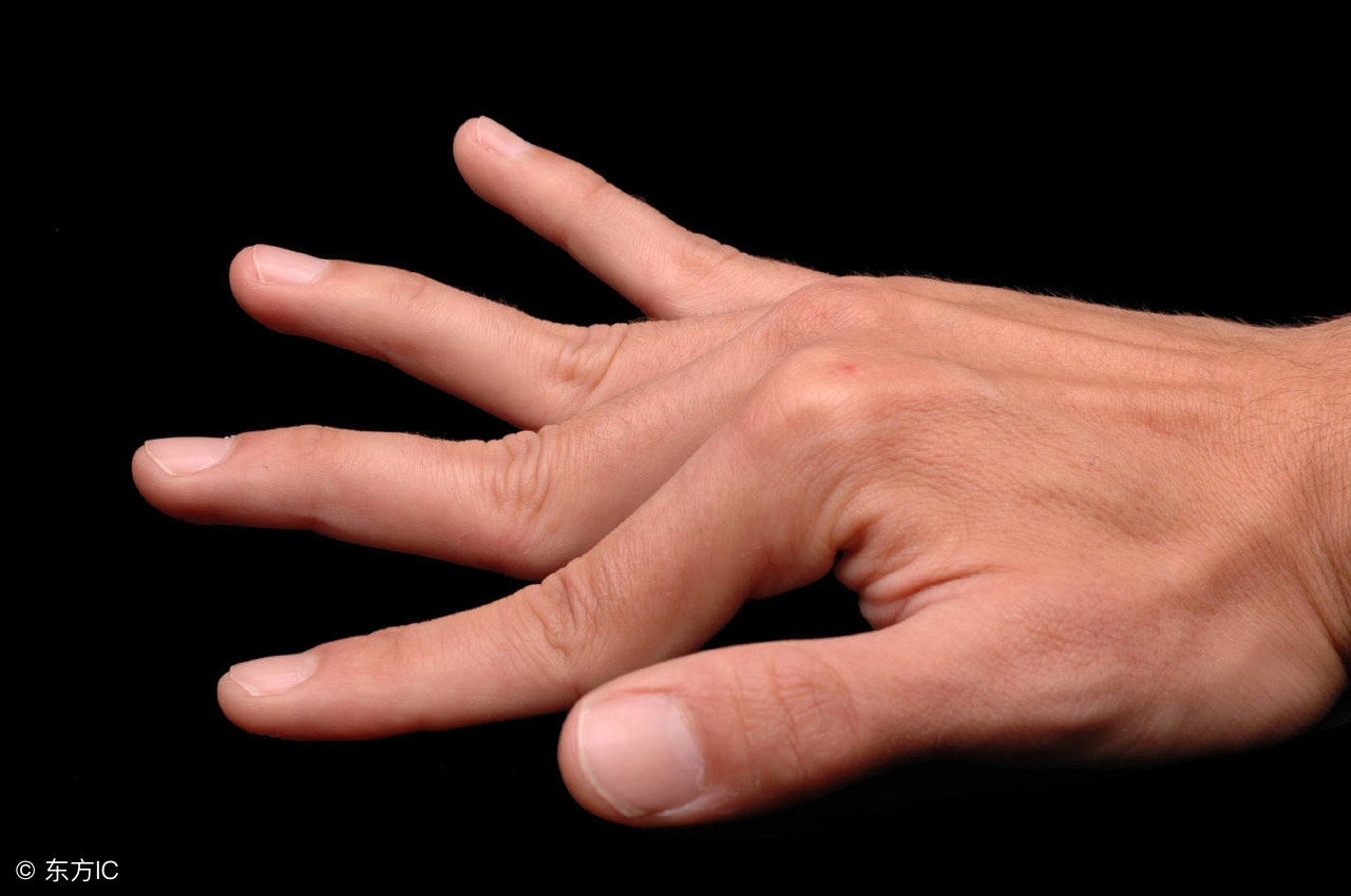 风湿性骨关节炎,骨关节炎与类风湿关节炎哪个严重