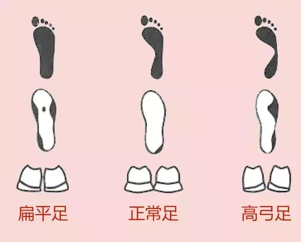 左后跟外侧磨鞋底是什么原因,左脚鞋底外侧磨得厉害怎么矫正