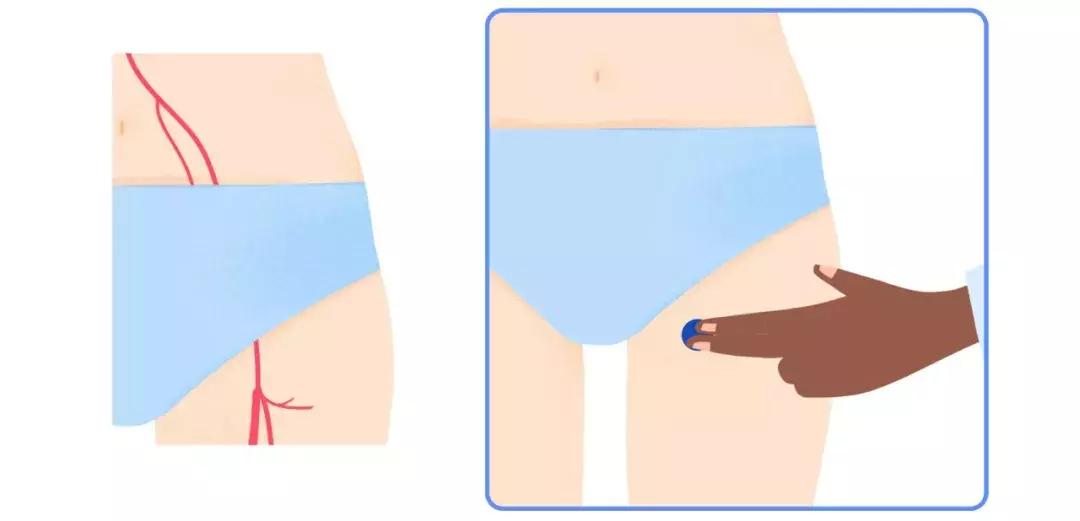 手腕测脉搏的方法,测脉搏的部位是哪里图