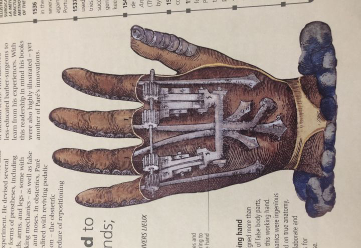 古代人骨折了没有手术怎么办,古代没有手术怎么治疗骨折