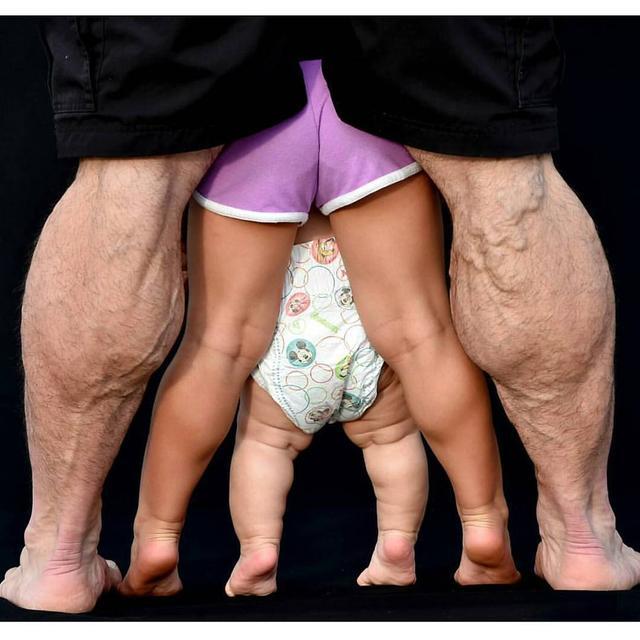 小腿腿型不好看怎么纠正,肌肉型小腿粗壮如何变细腿