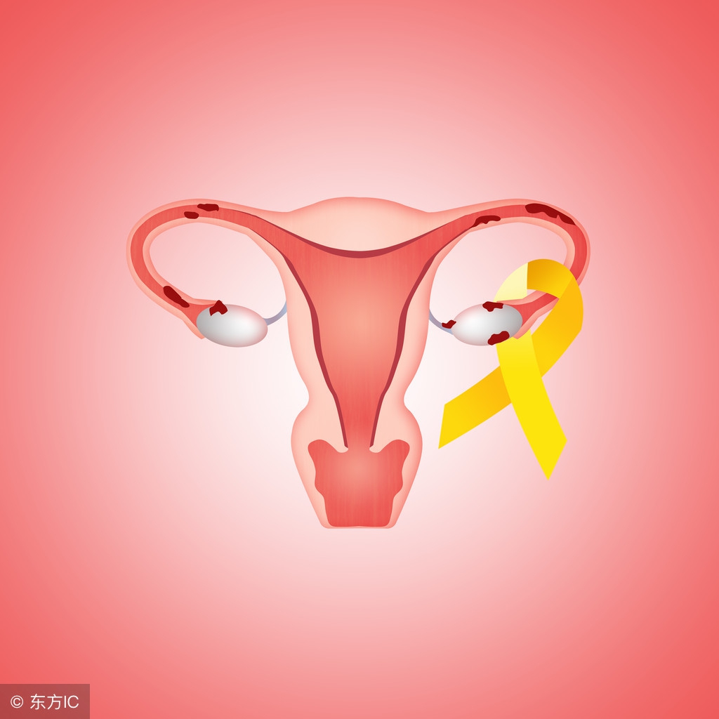 做完人流后怎样预防子宫内膜炎,流产后子宫内膜炎怎么治