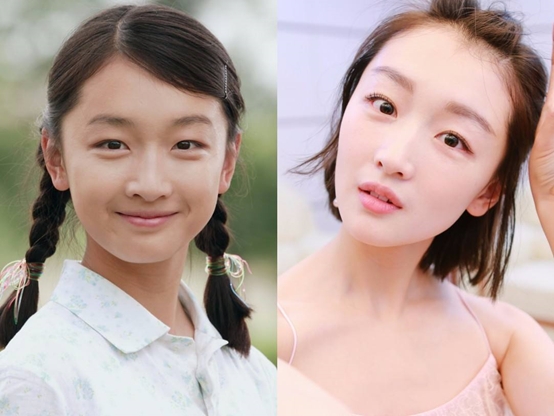 眼皮贴双眼皮肉条感怎么解决,眼皮厚重怎么贴双眼皮