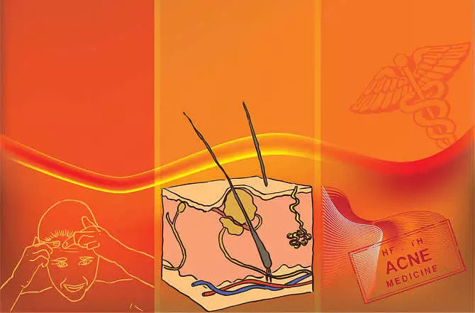 男孩子青春期脸上长痘痘怎样护理,脸上长痘痘皮肤很干