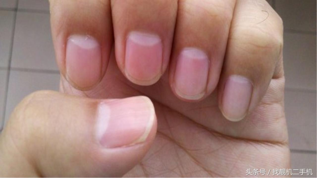 手指上没有月牙代表什么意思,十个手指都没有月牙这说明什么