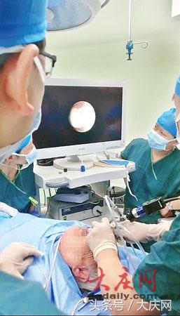 惹祸的蒜瓣！83岁老人蒜瓣呛入气管险窒息（图）