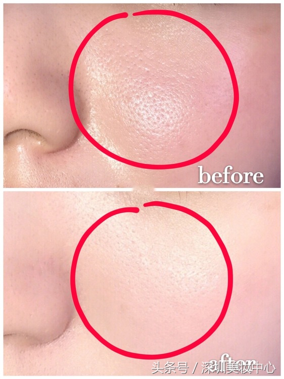熬夜去黄毛孔粗大护肤品,熬夜怎么拒绝肌肤暗沉
