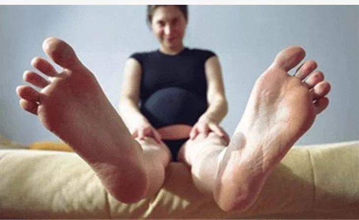 香港脚气最好的治疗方法,香港脚怎么彻底治愈