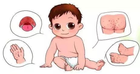 广西虫子如何预防,广西常见毒虫