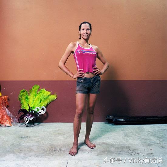 泰国人妖变性手术后寿命长吗,泰国人妖无死角变性手术