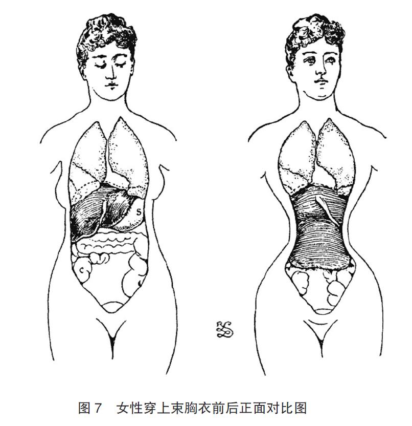 束胸衣效果展示,束胸衣显身材