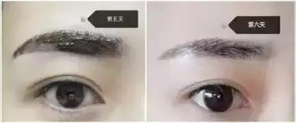 大浓眉如何彻底去除眉毛不再生长,半永久眉毛做完后还需要修眉吗