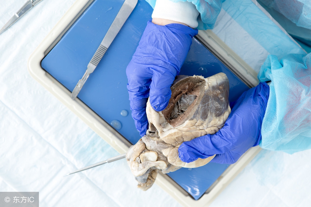 男子腹痛到医院就诊结果震惊,男子腹痛难忍医生一查