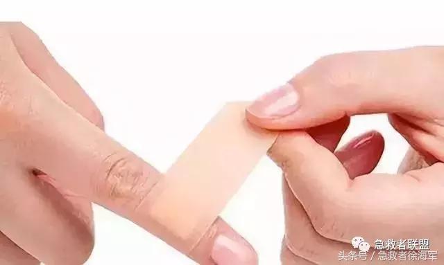 小伤口贴创可贴好还是不贴好得快,小伤口蔡依林