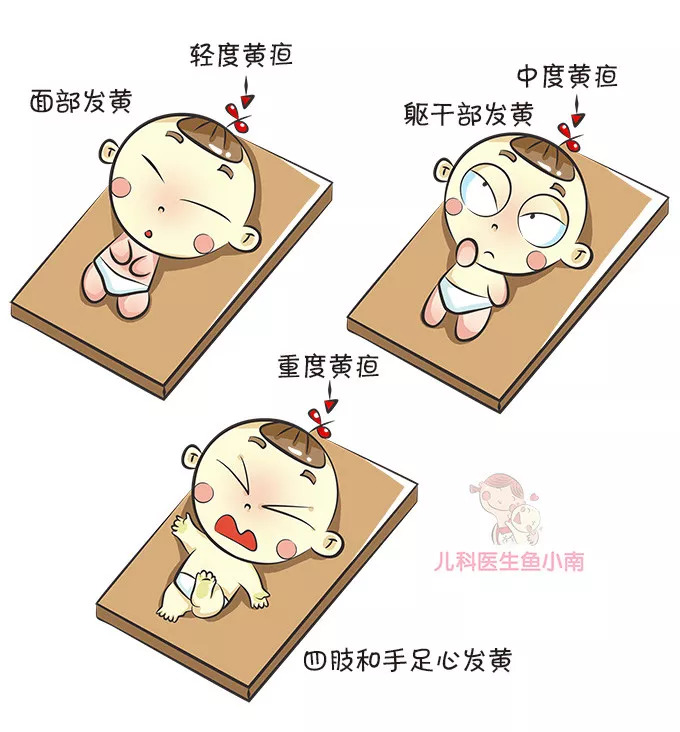 婴儿黄疸10个还用吃药吗,宝宝10天黄疸20严重吗