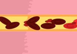 关于深海鱼油的真相,吃深海鱼油到底好不好