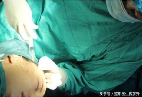 prp和自体脂肪哪个保持时间长点,prp填充和自体脂肪填充哪个好