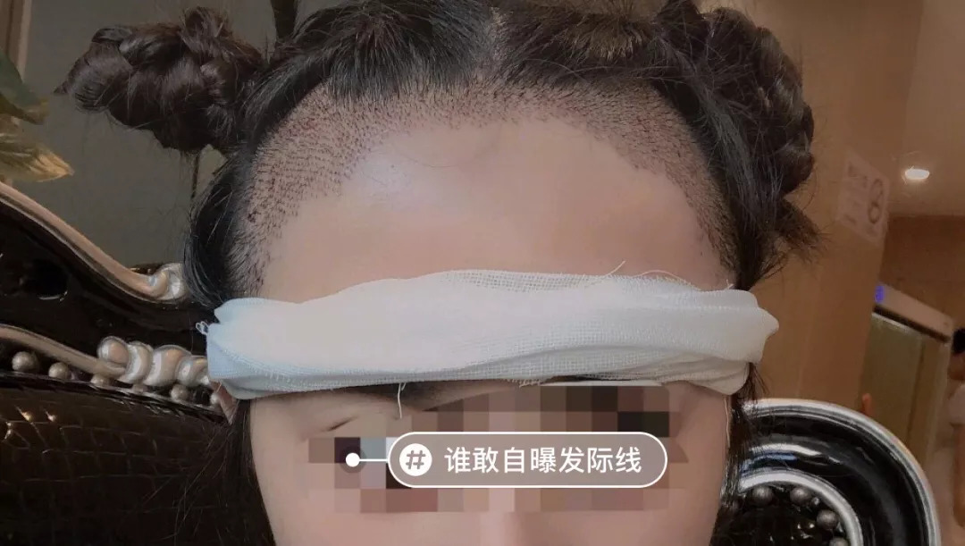 修理发际线男士,男生要不要修发际线