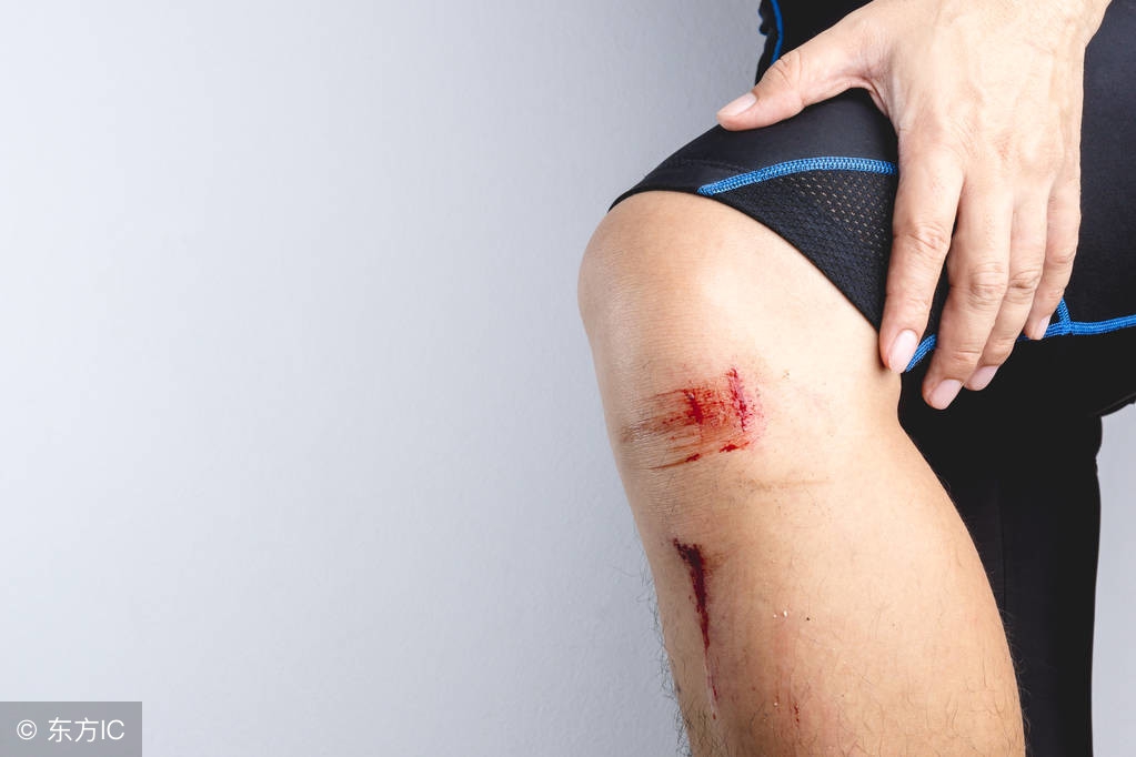 膝盖破皮可以跑步吗,跑步膝盖拉伤怎么办
