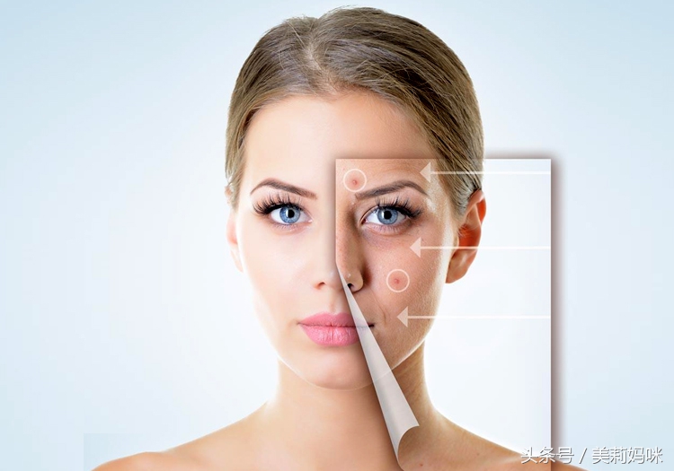 孕期长痘痘如何治好呢,孕期长痘痘有什么办法解决后背