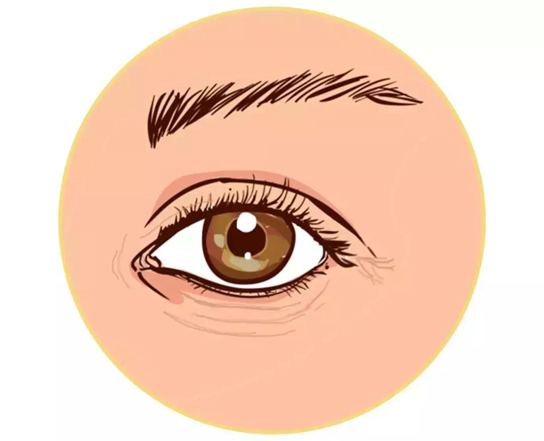 解决黑眼圈细纹最有效的方法,黑眼圈细纹比较严重怎么办