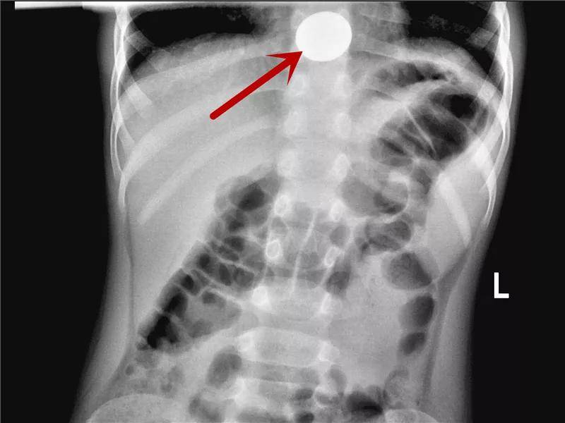 一些让人毛骨悚然拍到的照片,六个令人毛骨悚然的影像