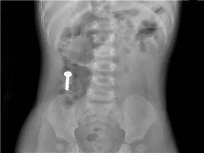 一些让人毛骨悚然拍到的照片,六个令人毛骨悚然的影像