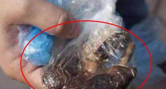 妻子多年不孕，医生竟从妻子身体里取去怪物，大开眼界