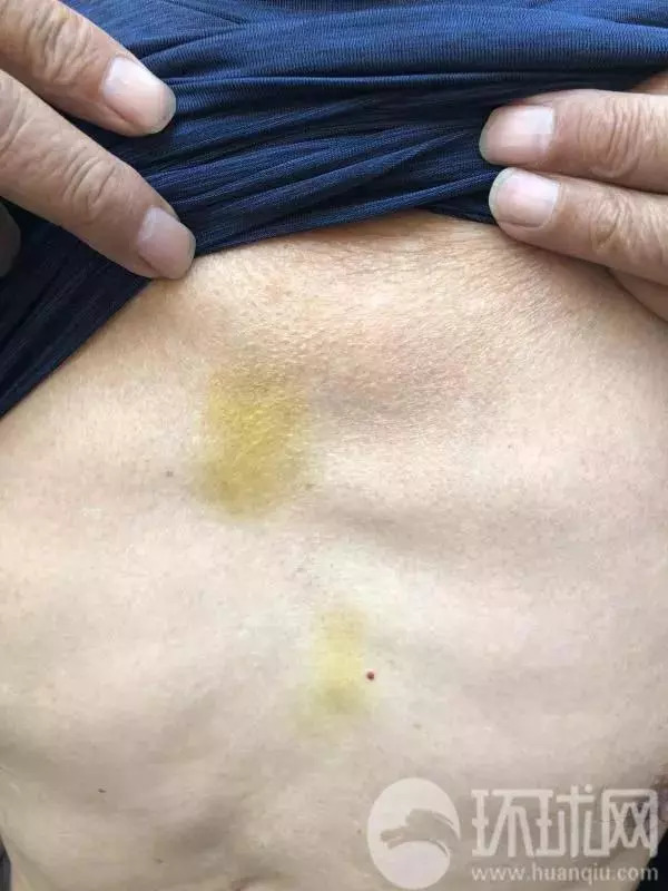 3名中国游客在瑞典遭粗暴对待,中国游客瑞典遭粗暴对待的真相