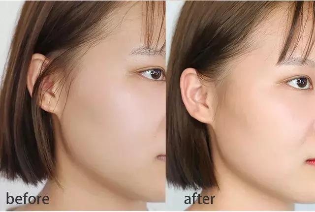 堪比整容的祛纹技巧,心机显瘦修容方法