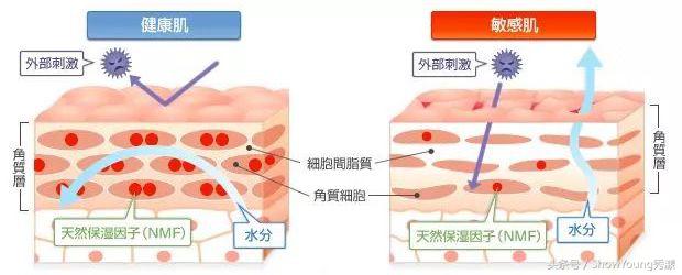 眼部过敏发红皱巴巴还脱皮,换季过敏脱皮怎么办