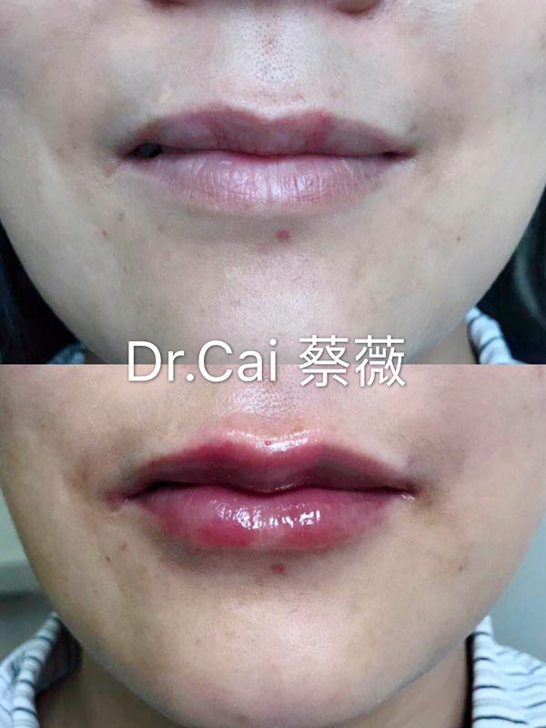 用一个星期变瘦变美,用一天的时间怎么变美