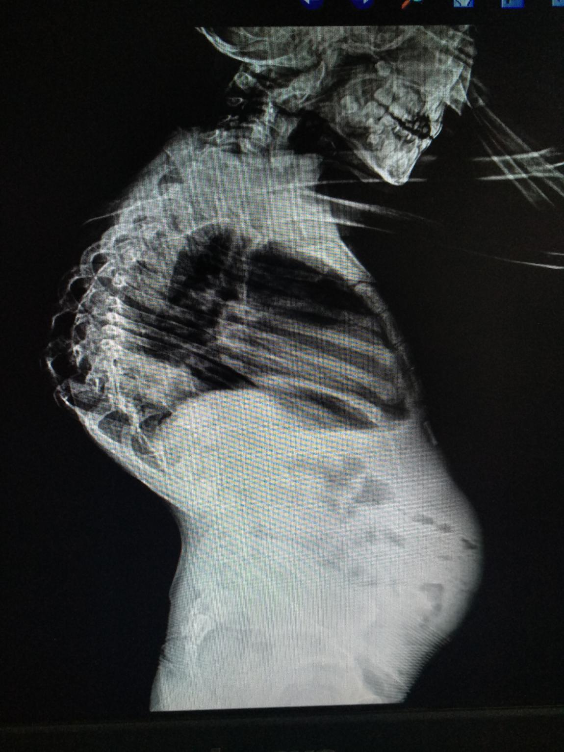 骨科专家帮扶,骨科下乡帮扶预期目标