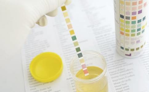 糖尿病酮症的酮体阳性指哪项,尿酮体和酮症酸中毒一样吗