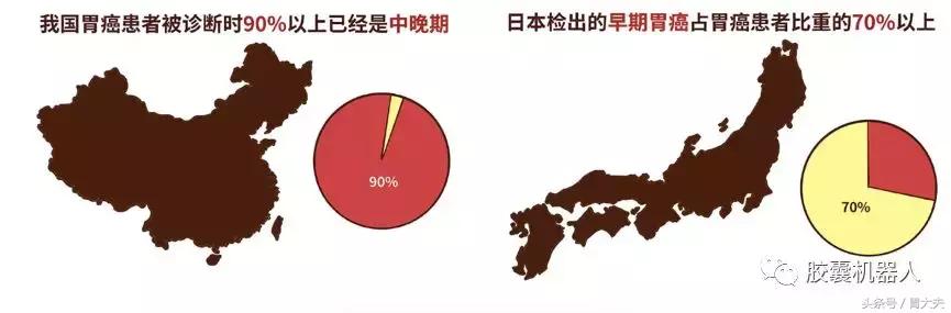 这6类人最好定期做胃镜检查,年轻人多久做一次胃镜体检比较好