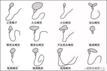 人类精子变少,40年男性精子数量