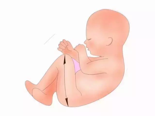 胎儿胎动b超视频,教看b超胎儿图片