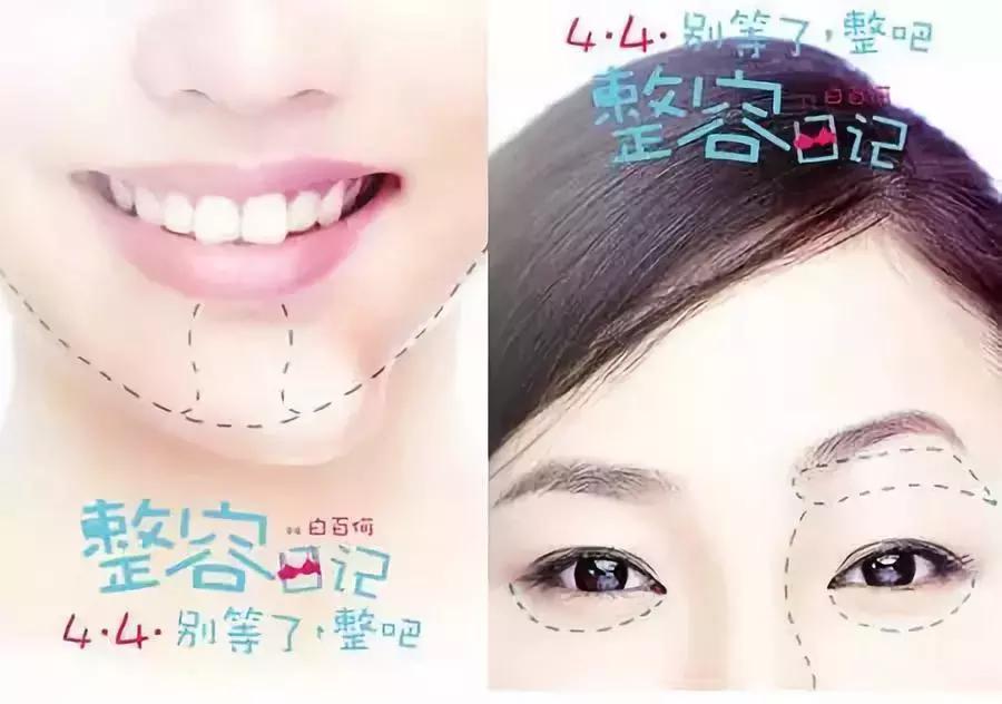 韩式整容全过程,日式整容和韩式整容