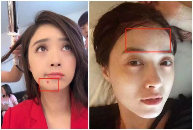 下巴最近反复长痘痘是什么原因,下巴频繁长痘痘是什么原因