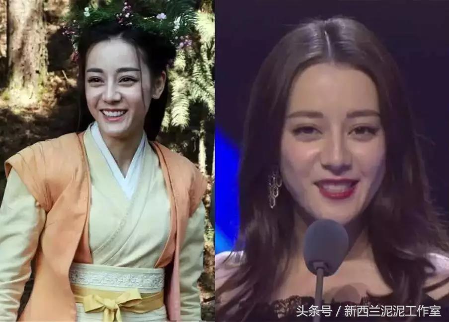 杨紫法令纹消除方法,女明星怎么解决法令纹的问题