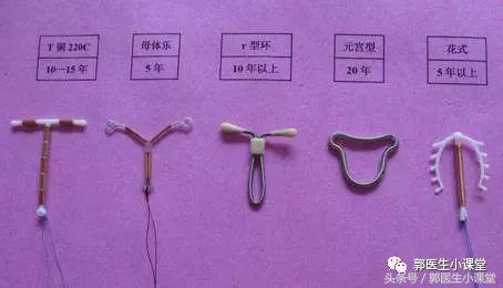 生完孩子结扎还是上环好,生完小孩就要上环吗