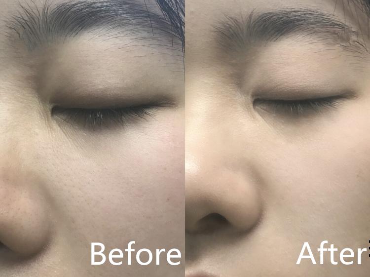 真的火了很多年的luna洁面仪,luna洁面仪韩国版