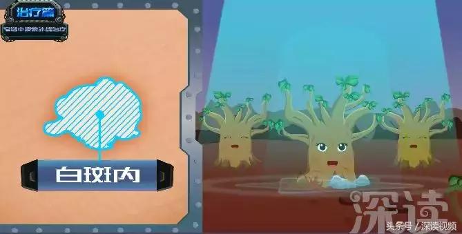 激光治疗和皮肤移植哪家强？治疗白癜风，最新黑科技大盘点