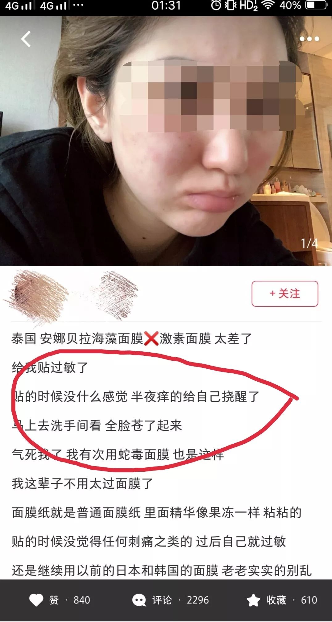 泰国蛇毒面膜为什么那么少,泰国面膜蛇毒面膜
