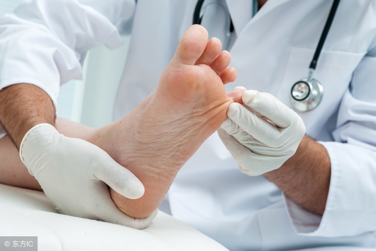 脚气症状和足癣的区别,脚气和手足癣是什么原因引起的