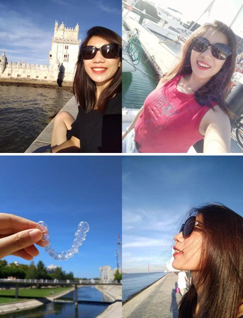 网上缺牙补贴是真的吗,缺牙人士看过来种牙补贴免费领