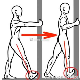 运动康复主诉,锻炼后肌肉酸疼怎么快速恢复